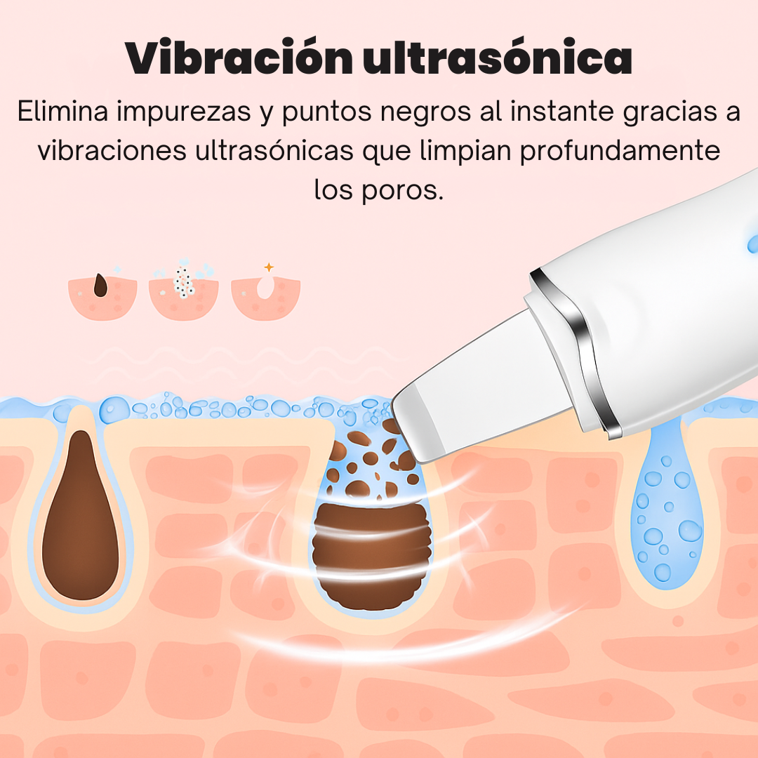 SkinLift™ – Limpieza Facial Profunda con Tecnología Ultrasónica