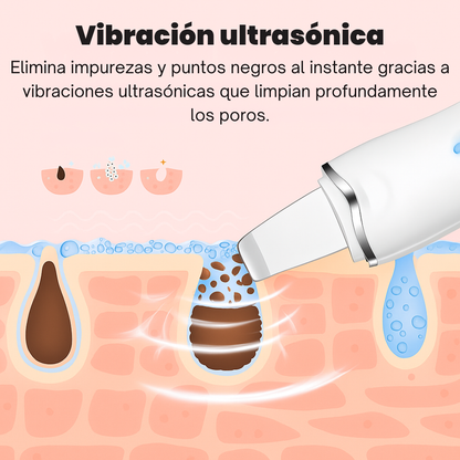 SkinLift™ – Limpieza Facial Profunda con Tecnología Ultrasónica