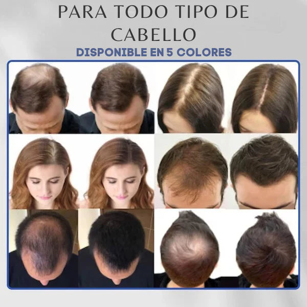 Toppik™ – Fibra Capilar: Densidad al instante